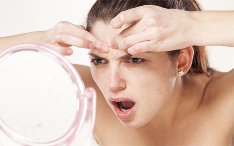 ACNE AND PIMPLES TREATMENTS